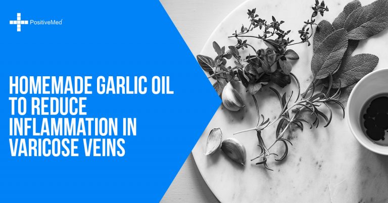Homemade Garlic Oil to Reduce Inflammation in Varicose Veins Homemade Garlic Oil to Reduce Inflammation in Varicose Veins