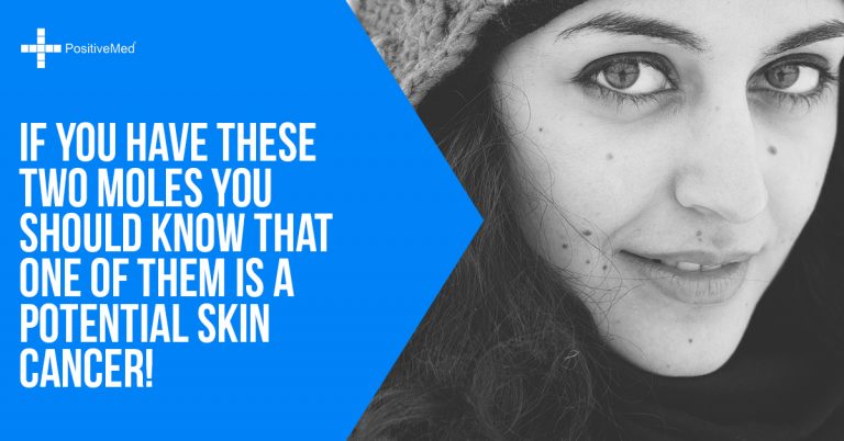 If You Have These Two Moles You Should Know That One of Them Is a Potential Skin Cancer! If You Have These Two Moles You Should Know That One of Them Is a Potential Skin Cancer!