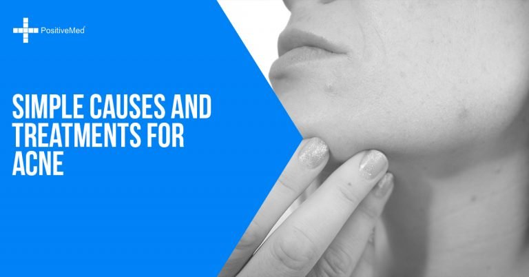 Simple Causes and Treatments for Acne Simple Causes and Treatments for Acne