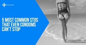 5 Most Common STDs That Even Condoms Can't Stop