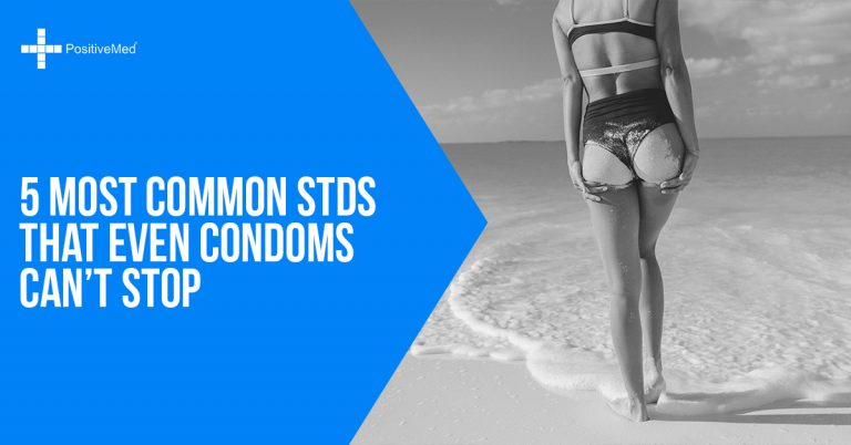 5 Most Common STDs That Even Condoms Can’t Stop