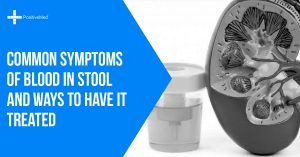 Common Symptoms of Blood in Stool and Ways to Have it Treated