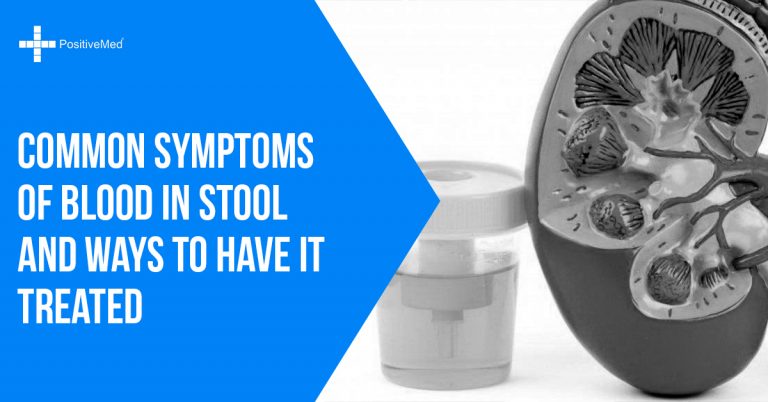 Common Symptoms of Blood in Stool and Ways to Have it Treated Common Symptoms of Blood in Stool and Ways to Have it Treated