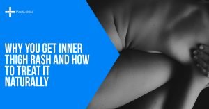 Why You Get Inner Thigh Rash and How To Treat It Naturally