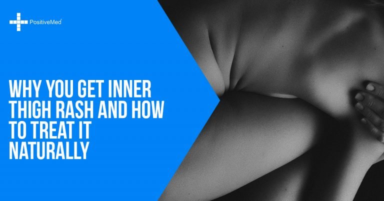 Why You Get Inner Thigh Rash and How To Treat It Naturally