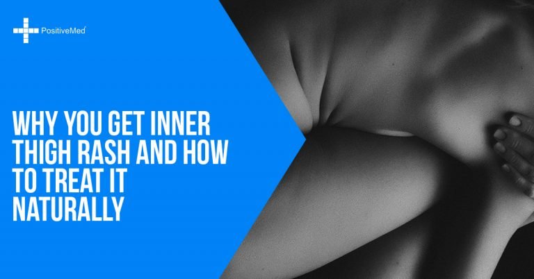 Why You Get Inner Thigh Rash and How To Treat It Naturally Why You Get Inner Thigh Rash and How To Treat It Naturally
