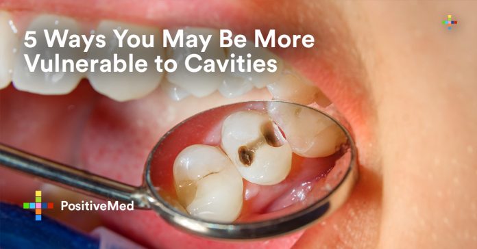 5 Ways You May Be More Vulnerable to Cavities