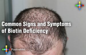 Common Signs and Symptoms of Biotin Deficiency