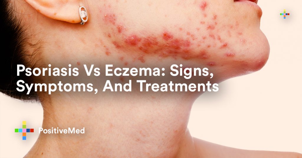 Psoriasis Vs Eczema Signs, Symptoms, And Treatments