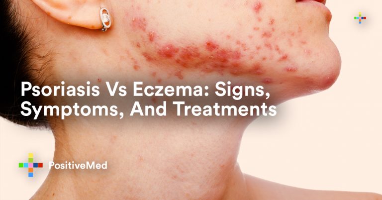 Psoriasis Vs Eczema: Signs, Symptoms, And Treatments Psoriasis Vs Eczema: Signs, Symptoms, And Treatments