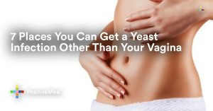 7 Places You Can Get a Yeast Infection Other Than Your Vagina