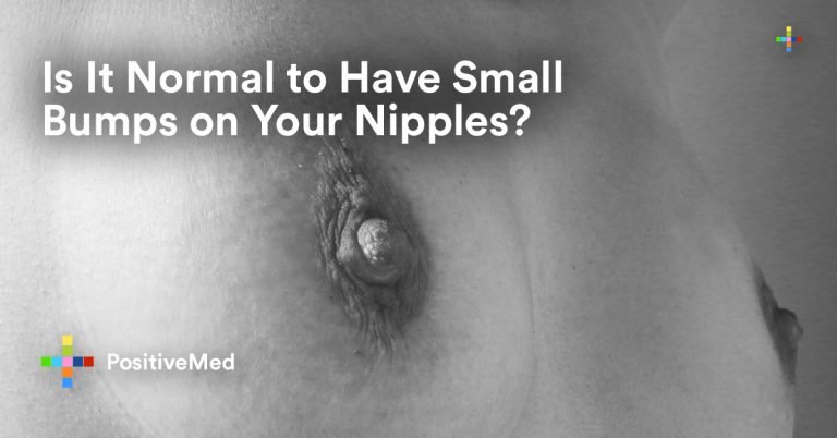 Is It Normal to Have Small Bumps on Your Nipples?