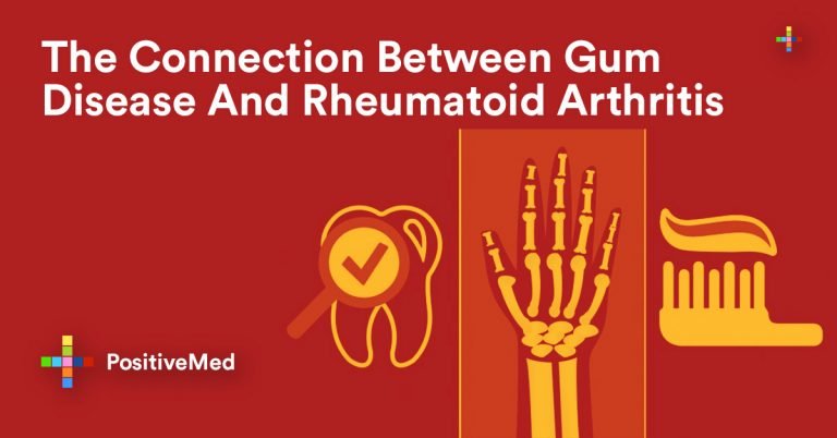 The Connection Between Gum Disease And Rheumatoid Arthritis The Connection Between Gum Disease And Rheumatoid Arthritis