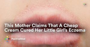 This Mother Claims That A Cheap Cream Cured Her Little Girl’s Eczema