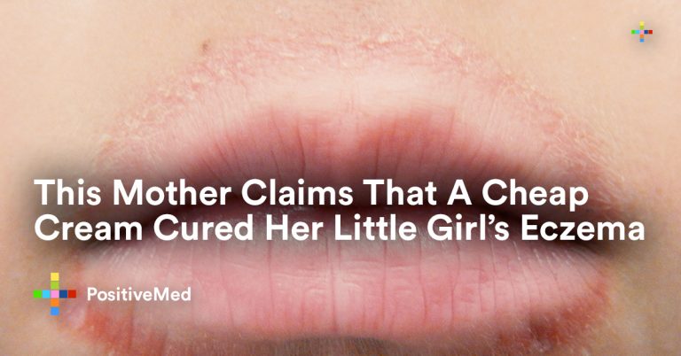 This Mother Claims That A Cheap Cream Cured Her Little Girl’s Eczema This Mother Claims That A Cheap Cream Cured Her Little Girl’s Eczema