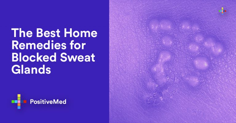 The Best Home Remedies for Blocked Sweat Glands
