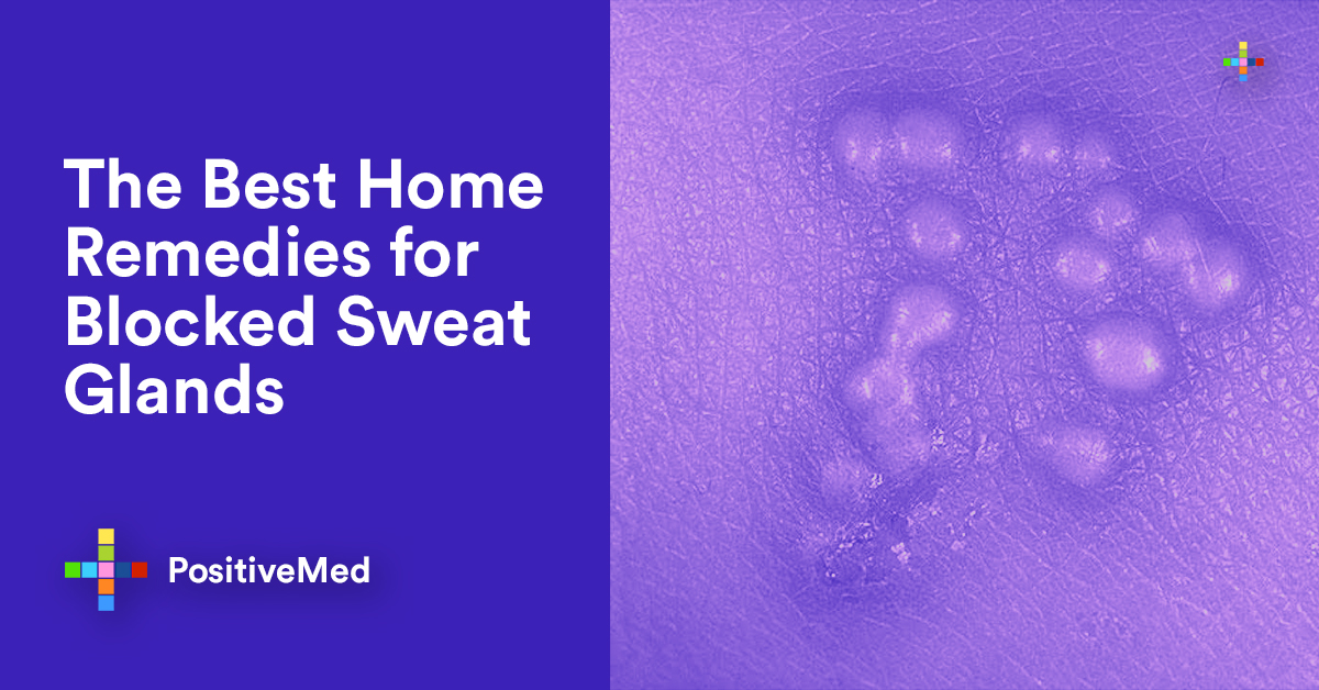 The Best Home Remedies For Blocked Sweat Glands