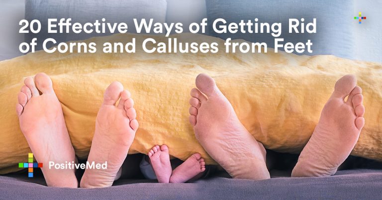 20 Effective Ways of Getting Rid of Corns and Calluses from Feet 20 Effective Ways of Getting Rid of Corns and Calluses from Feet