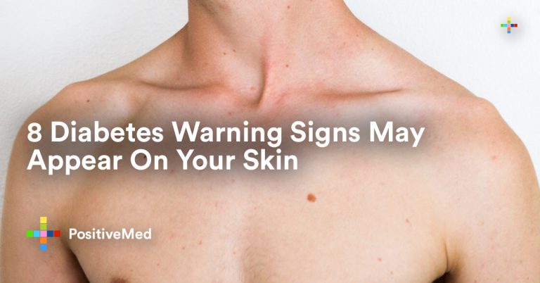 8 Diabetes Warning Signs May Appear On Your Skin