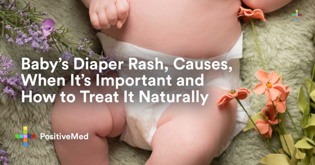 Baby's Diaper Rash, Causes, When It's Important and How to Treat It Naturally