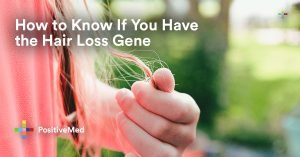 How to Know If You Have the Hair Loss Gene