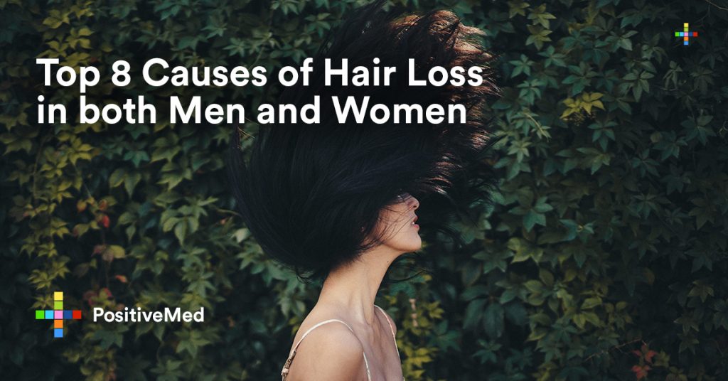 Top 8 Causes of Hair Loss in both Men and Women