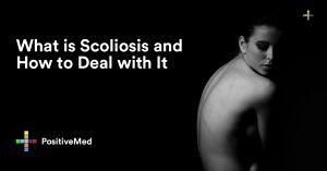 What is Scoliosis and How to Deal with It.