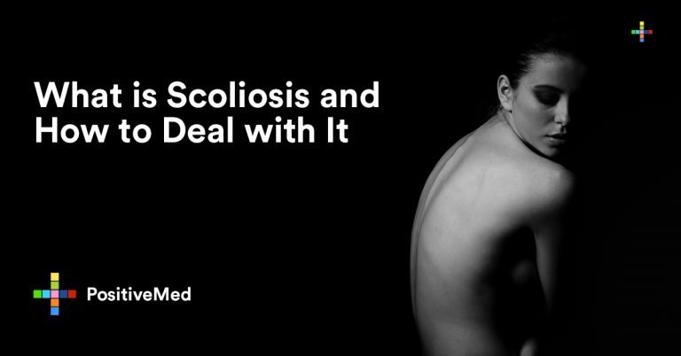 What is Scoliosis and How to Deal with It What is Scoliosis and How to Deal with It