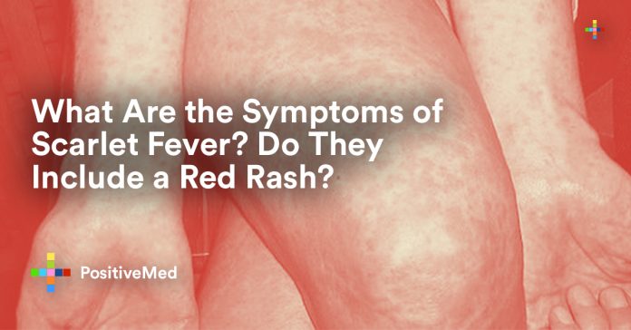 What Are the Symptoms of Scarlet Fever? Do They Include a Red Rash?