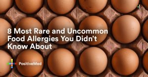 8 Most Rare and Uncommon Food Allergies You Didn't Know About