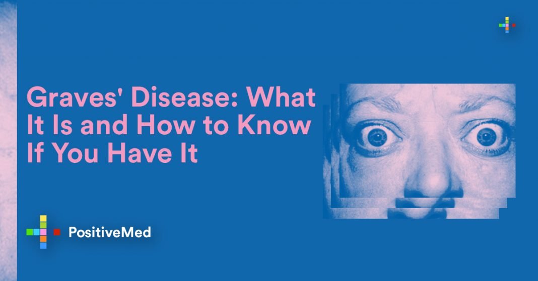 Telling Signs of Graves' Disease