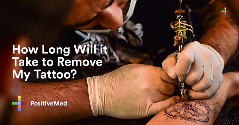 How Long Will It Take to Remove My Tattoo? How Long Will It Take to Remove My Tattoo?
