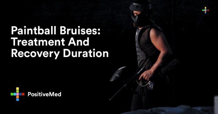 Paintball Bruises Treatment And Recovery Duration.