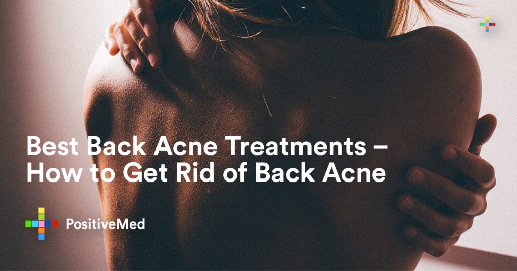 Best Back Acne Treatments - How to Get Rid of Back Acne