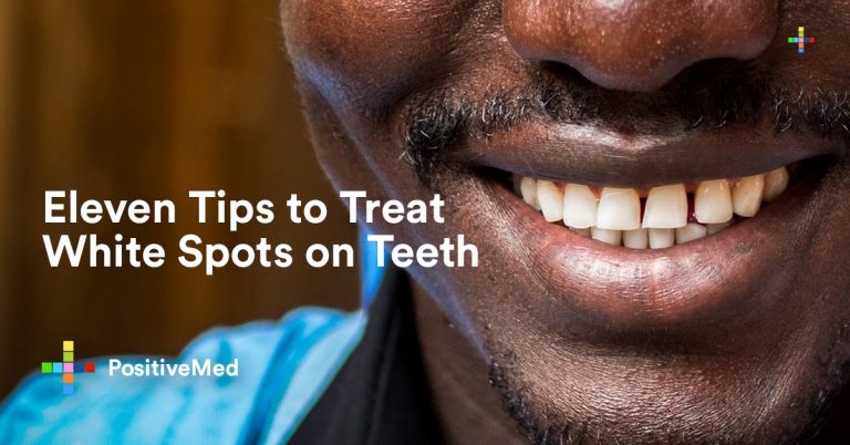 11 Tips to Treat White Spots on Teeth 11 Tips to Treat White Spots on Teeth