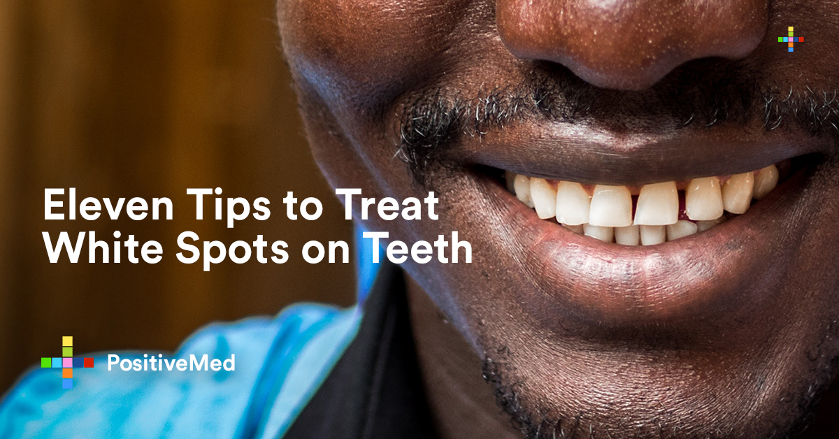 Eleven Tips to Treat White Spots on Teeth