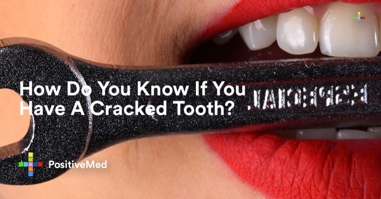 How Do You Know If You Have A Cracked Tooth?