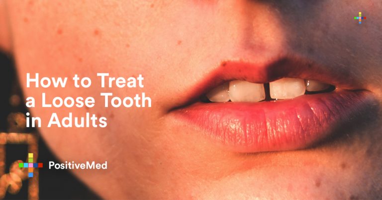 How to Treat a Loose Tooth in Adults
