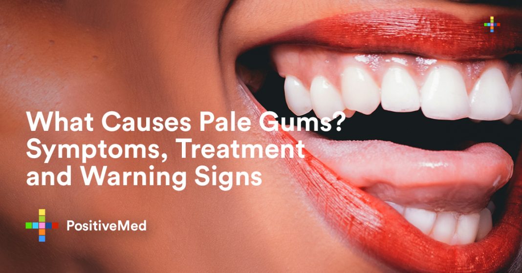 What Causes Pale Gums? Symptoms, Treatment and Warning Signs