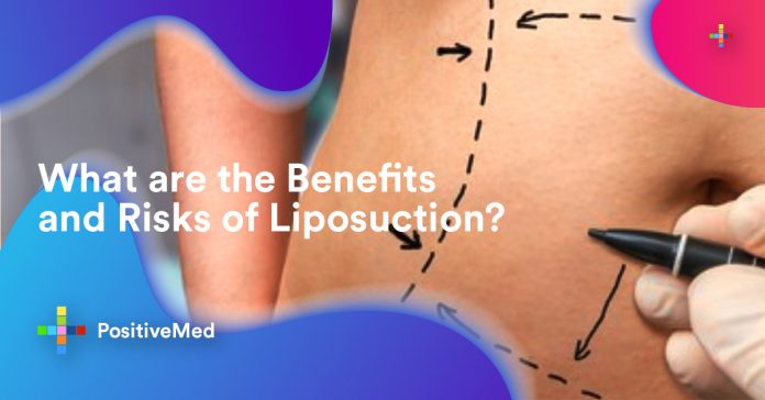 What are the Benefits and Risks of Liposuction