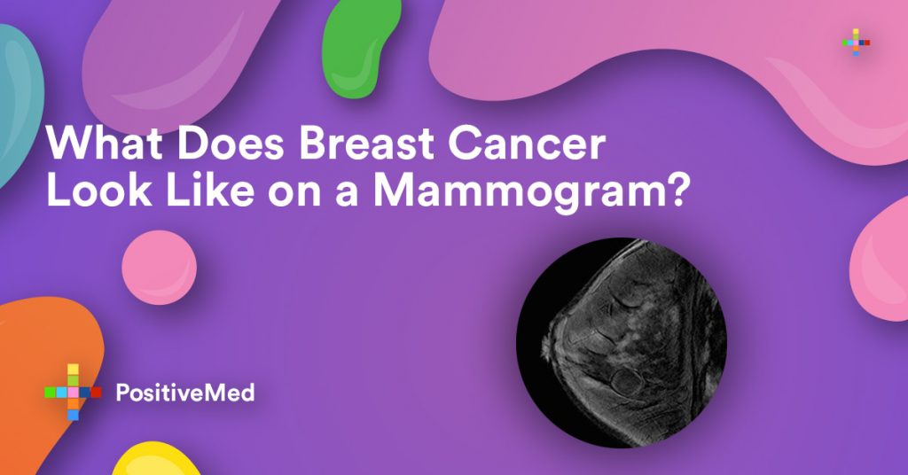 What Does Breast Cancer Look Like on a Mammogram