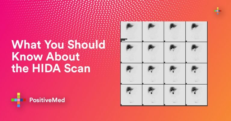 What You Should Know About the HIDA Scan What You Should Know About the HIDA Scan
