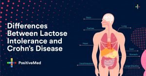 Differences Between Lactose Intolerance and Crohn's Disease