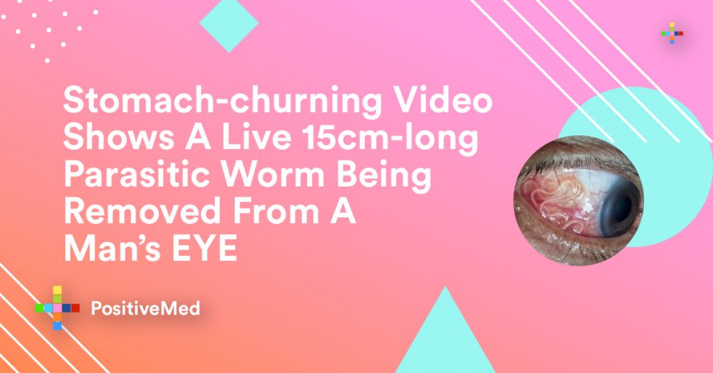 Stomach-churning Video Shows A Live 15cm-long Parasitic Worm Being Removed From A Man's EYE
