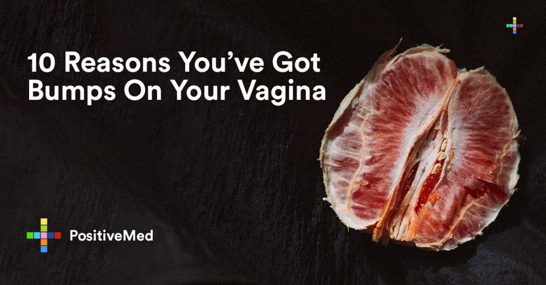 10 Reasons You Have Got Bumps On Your Vagina