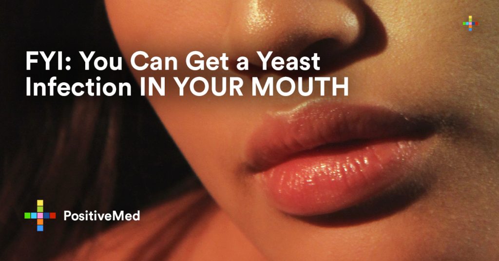 FYI You Can Get a Yeast Infection IN YOUR MOUTH