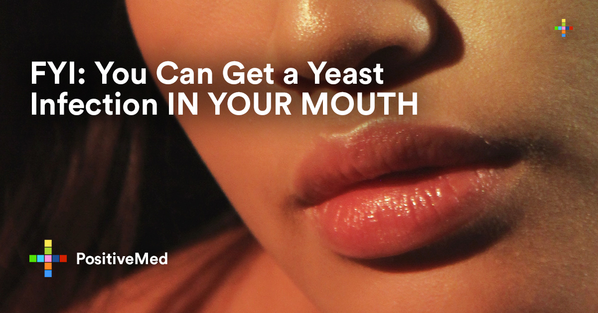 Best of Oral yeast infection in adults infection adults yeast Oral in