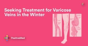 Seeking Treatment for Varicose Veins in the Winter