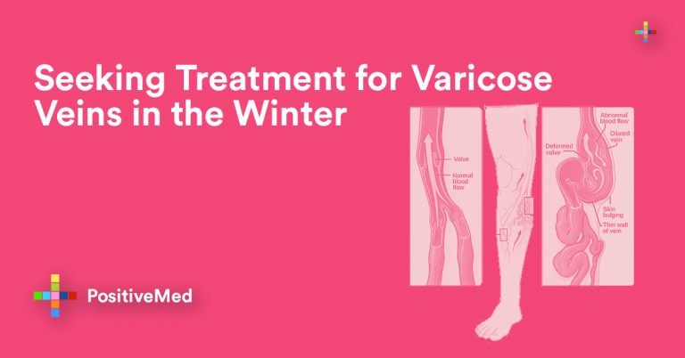 Seeking Treatment for Varicose Veins in the Winter Seeking Treatment for Varicose Veins in the Winter