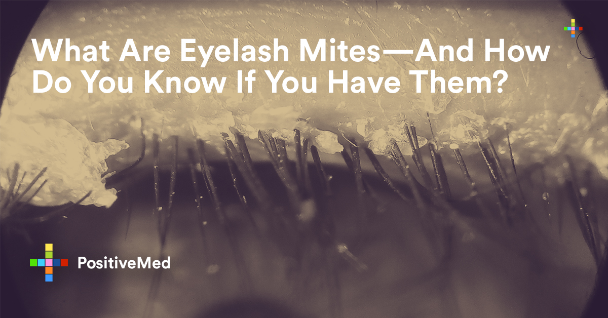 What Are Eyelash Mites—And How Do You Know If You Have Them?